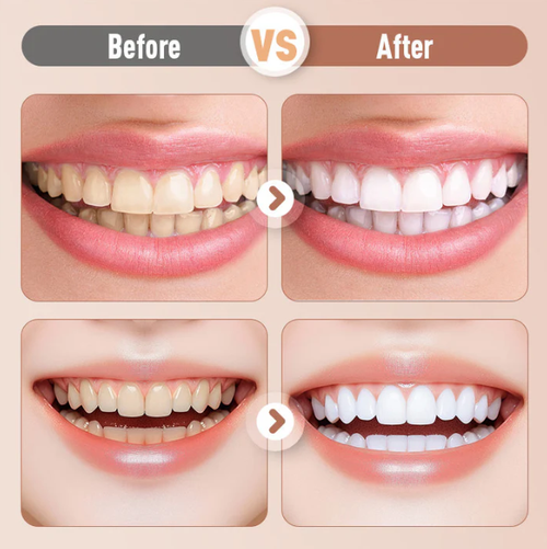 Rechargeable Sonic Electric Toothbrush For Adults
