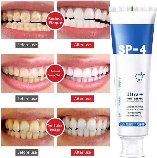 Yayashi SP-4 Probiotic Toothpaste - Brightening, Fresh Breath, Whitening, Natural Tooth Whitener