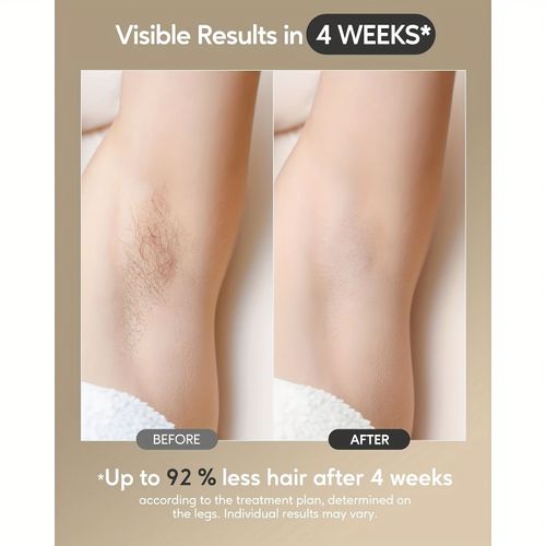 Hair Removal with Ice Cooling Function