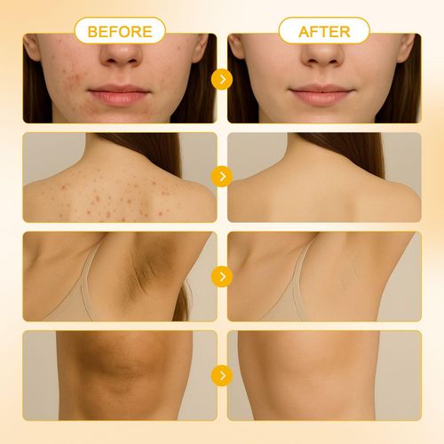 New Product Natural Vegan Turmeric Lemon Soap Anti-Acne Goat Milk Soap Whitening Handmade Oatmeal Facial Bath Bath Soap