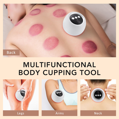 Electric cupping machine