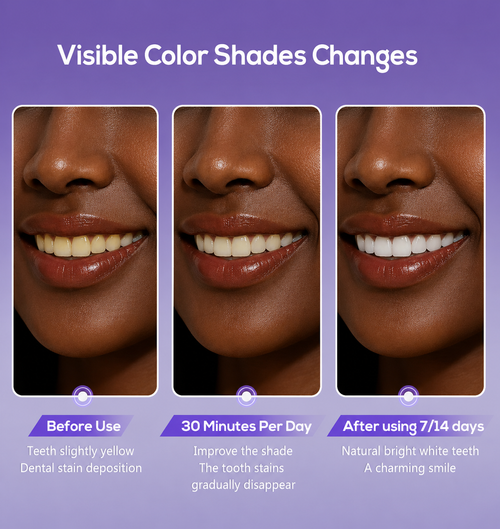 Purple Whitening Strips