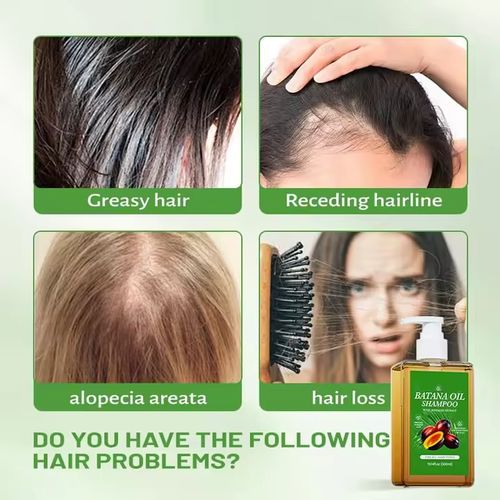 Rosemary Hair Strengthening & Growth Shampoo Landing Page Copy