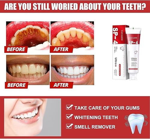 🔥Last Day 49% Sp-4 Probiotic Whitening Toothpaste, Ultra Whitening Toothpaste, Sp-4 Ultra Whitening (Red)