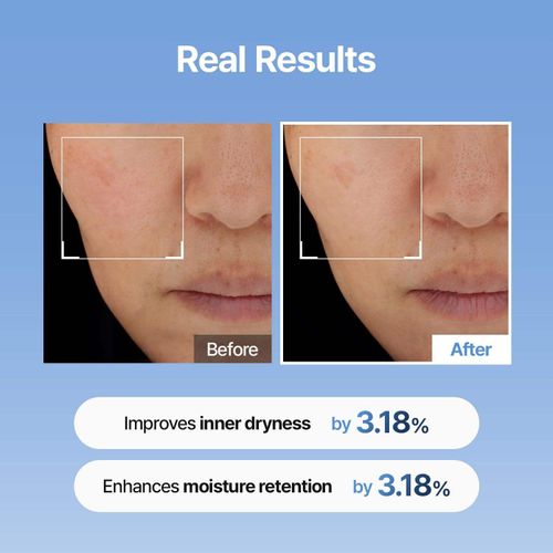 Hyaluronic Acid Serum