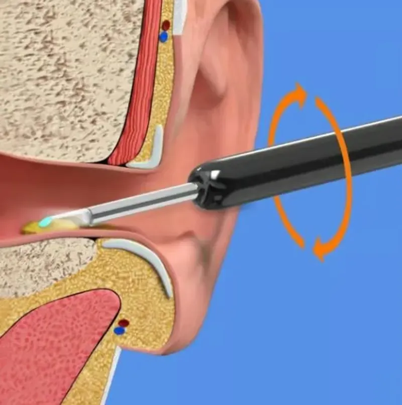 🔥🔥Wireless WIFI Visual Ear Pick
