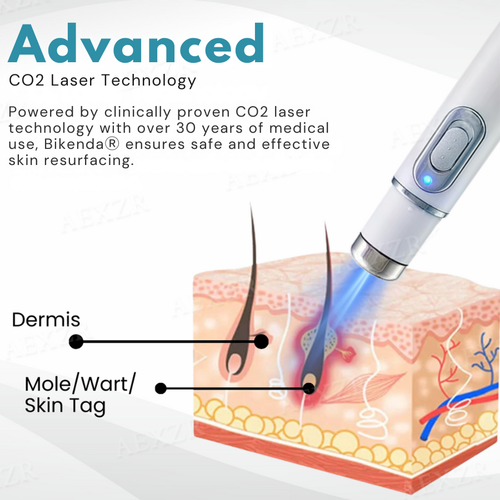 ⚡️BEST DEAL TODAY🔥Non-Invasive Mole and Wart Removal Laser Pen