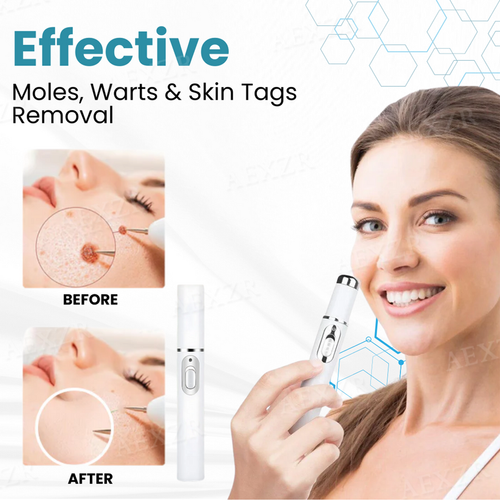 ⚡️BEST DEAL TODAY🔥Non-Invasive Mole and Wart Removal Laser Pen