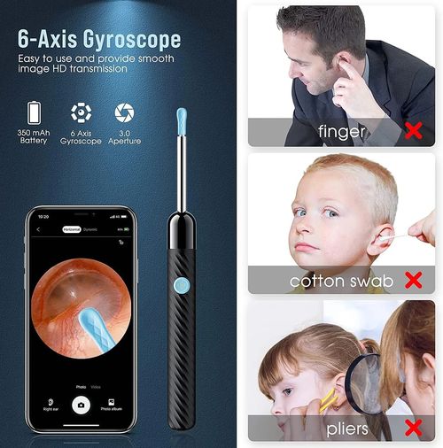 Ear Cleaning Tool Kit with Camera - 1080p HD Quality Video