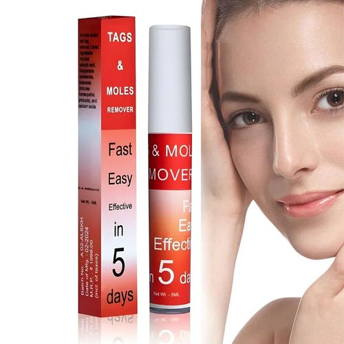 New Arrival  Tags & Moles Remover