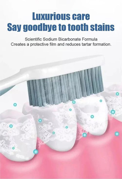 SP-4 Probiotic Whitening Toothpaste, Teeth Whitening Toothpaste (Pack of 1)
