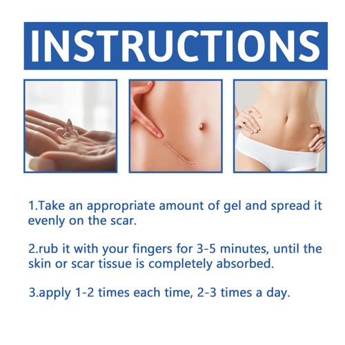 Scar Treatment Skin Care Cream Smooth Surgery Hyperplasia Scars Removal Stretch Marks Burns Repair Body Damaged Skin Gel Serum