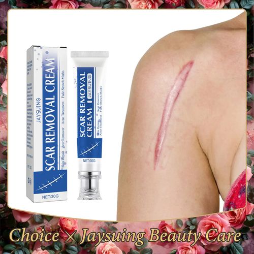 Scar Treatment Skin Care Cream Smooth Surgery Hyperplasia Scars Removal Stretch Marks Burns Repair Body Damaged Skin Gel Serum