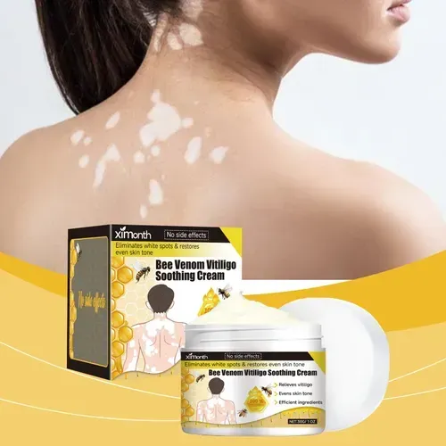 Don't miss out on today's exclusive offer! Get bottles of Bee Venom Vitiligo Soothing Repair Cream at once. The core ingredients of bee venom deeply nourish the skin base, promote cell regeneration and enhance self-repairing ability. It gently acts on the affected areas, gradually blurring the edges of the spots and making the skin complexion even, with no side effects and providing peace of mind.it's a must-have for skin care.