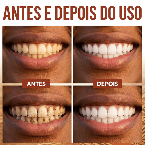 Pasta de Dentes SP-4 ✨ Sorriso Mais Branco e Hálito Fresco com Probióticos 🌿 Remove Manchas Naturalmente 🦷 🛵 Entrega em Luanda Pagas na Entrega 💸