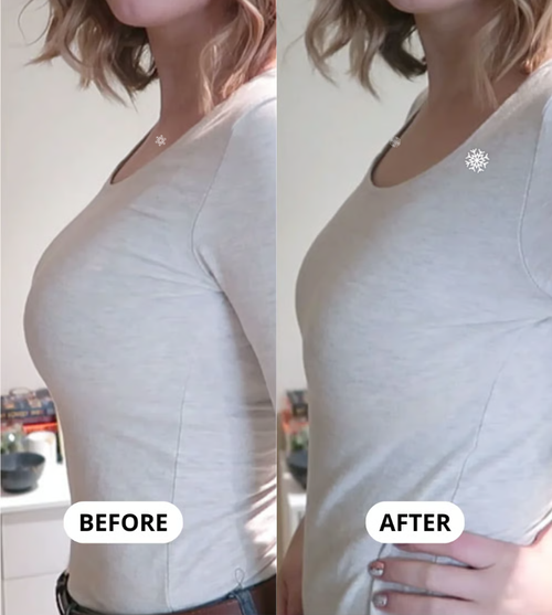 🔥2025 New Breast Minimizer Bra