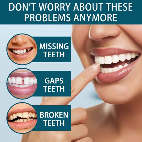 Snap It On, Smile Confidently – A Perfect Fit in Seconds!