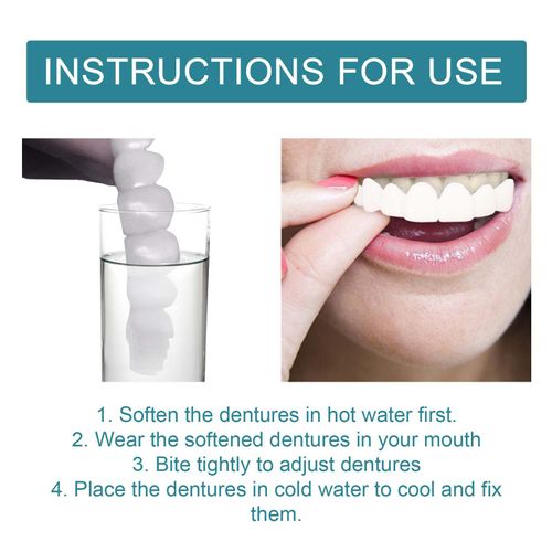 Snap It On, Smile Confidently – A Perfect Fit in Seconds!