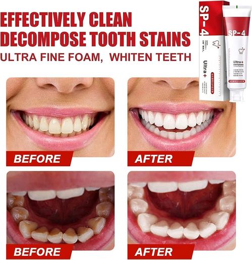 Ultra SP-4 Probiotic Whitening Toothpaste (Red)