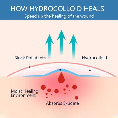 Acne patches（tape shape）