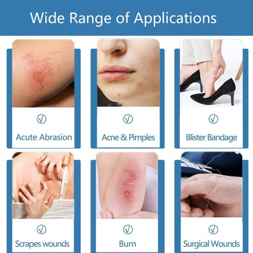 Acne patches（tape shape）