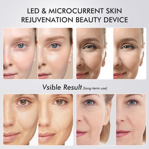 😍New arrival! 5-color light beauty instrument with EMS microcurrent and vibration massage. Red and blue light care for tightening pores. Helps you glow and start a new beauty journey. Come and try it if you love beauty! 😘