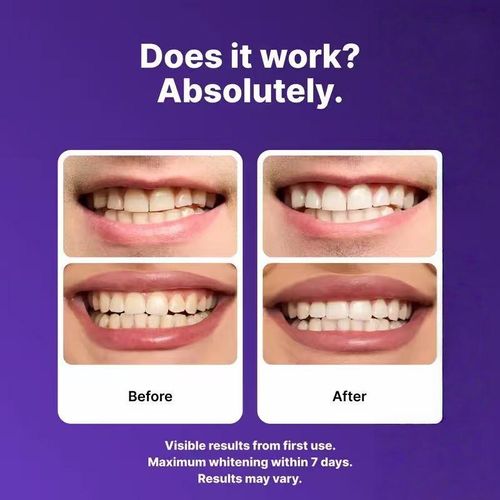 Whitening strips, home use, antibacterial, non-toxic, safe for protecting tooth enamel - gentle and non-irritating - peroxide-free