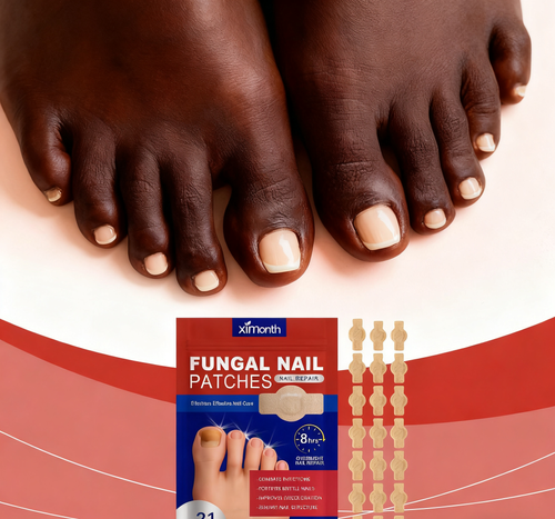 Adesivo corretor e reparador de unhas, restauração de unhas com fungo, cuidado dos pés, adesivo para inflamação da cutícula, adesivo antibacteriano para unhas