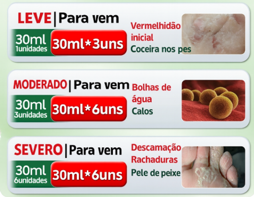 Pomada Antifúngica Rei dos Fungos Adeus Coceira, Feridas e Mau Odor nos Pés 🦶🔥