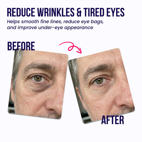✨DLJ-Cepin✨Under-Eye Repair Patches