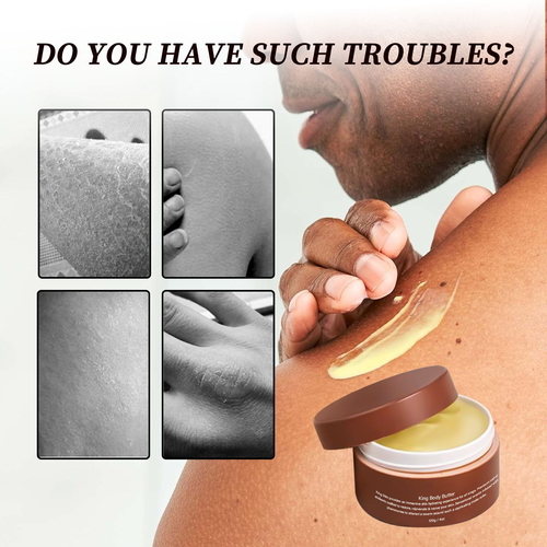 ✨DLJ✨Body Lotion Relieves Dry Skin and Hydrates