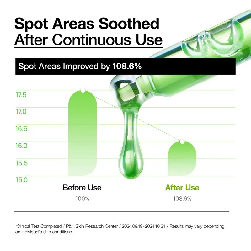 Azelaic Acid 10 Hyaluron Redness Soothing Serum 1.01 fl.oz.(30ml)｜Azelaicacid, Hyaluronic Acid, Non-Poreclogging, korean skincare, soothing, redness, sensitive skin, acne-prone