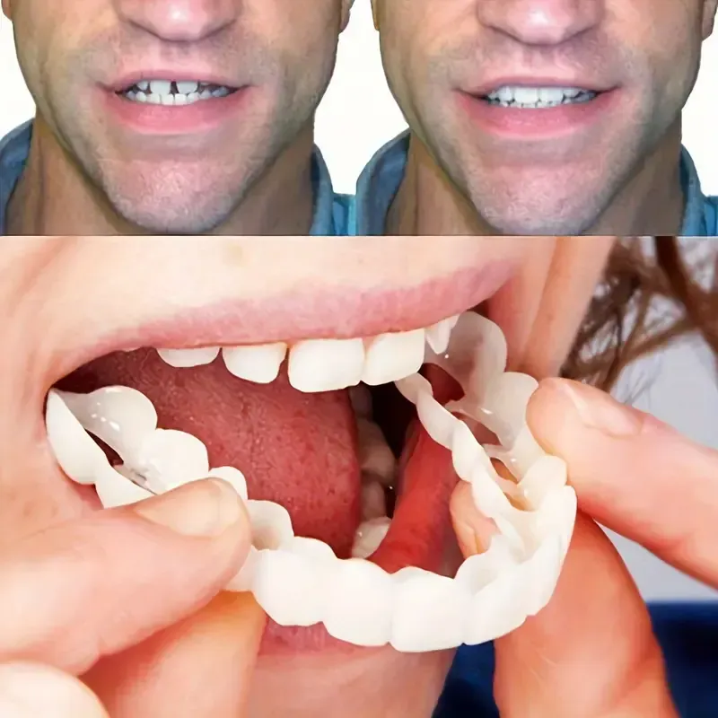 1  white cosmetic dentures