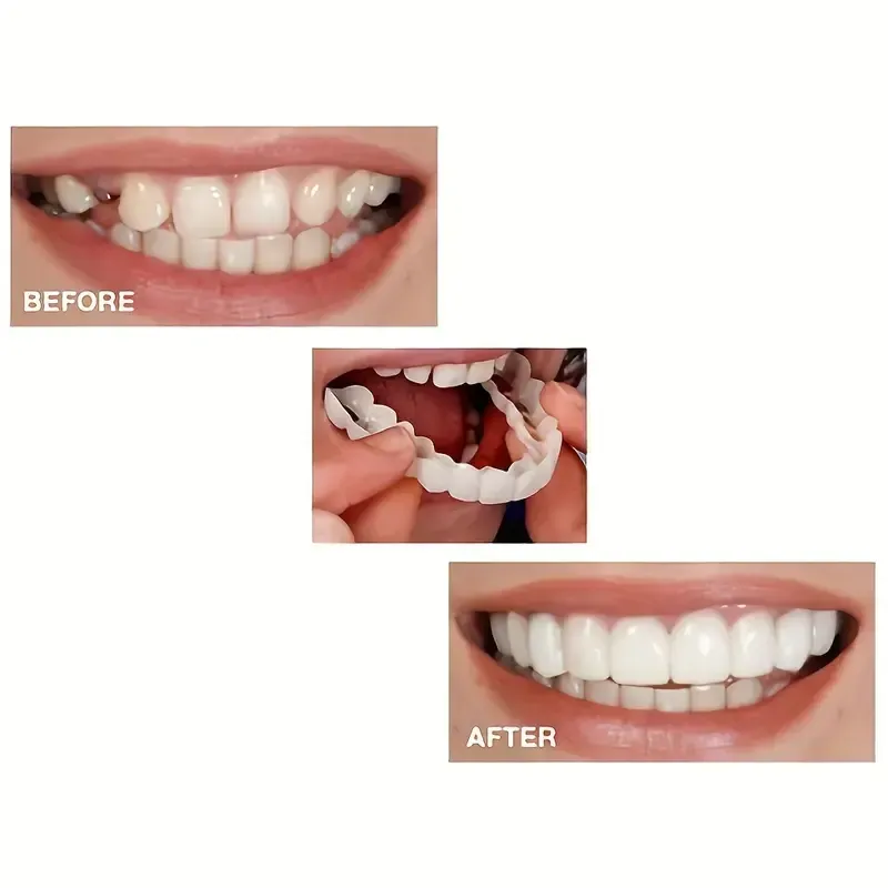 1  white cosmetic dentures