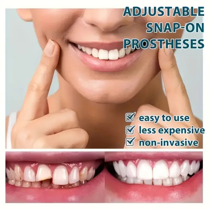 1  white cosmetic dentures