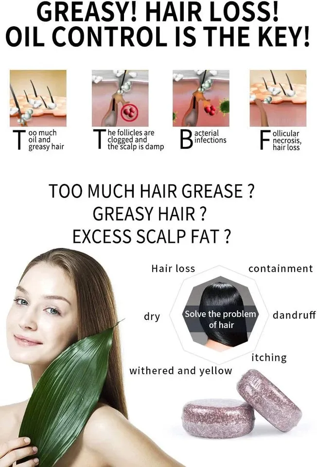 Can Amino Acid Shampoo Bars Really Make Hair Thicker? Say Goodbye to Hair Loss by Starting with a Healthy Scalp