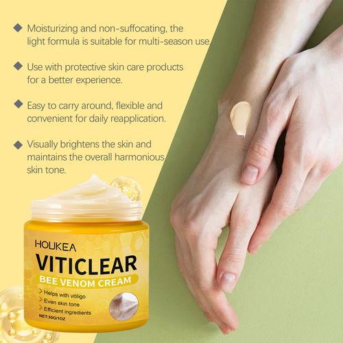 Order today and you'll receive 3 bottles of the anti-leukoplakia herbal extract essence cream. This cream features a blend of herbal extracts and bee venom. It can lighten the spots and even out the skin tone. The cream has a smooth texture that absorbs quickly without leaving a sticky feeling. Even those with sensitive skin can use it. Whether it's localized pigmentation spots or the whitish marks left after sun exposure, you'll start seeing results after using it consistently for two weeks.