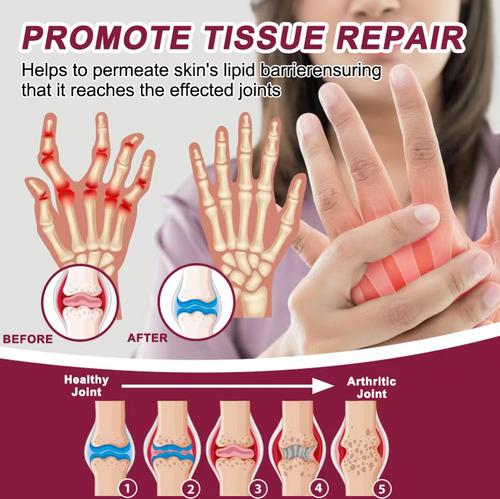 Order today and you will receive 3 boxes of the powerful natural ingredient venom filtrate joint and bone treatment cream, totaling 150g. Each box contains 50g of the product. It can penetrate the skin and provide protection for the joints, relieving stiffness and pain. It is suitable for all joints and has a refreshing texture without any greasiness. For all people's daily joint care, this is a convenient and excellent product.