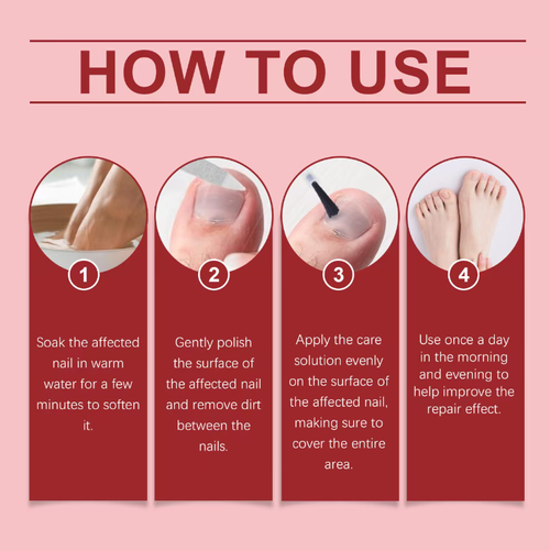 Order today and you will receive 3 bottles of the skin doctor-recommended herbal gentle nail care lotion. This product uses plant power to gently repair damaged nails, allowing you to regain a healthy and shiny nail surface. The essence formula is mild in its antibacterial properties, improving the yellowish and thickened nail surface. The brush design is easy to apply, effectively repairing damaged nails, suitable for people with onychomycosis and those who need nail repair after manicures.