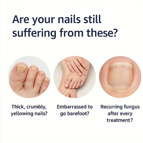 If you place an order today, you will receive 6 units, which is a complete course of treatment. The anti-fungal care pen contains 25% undecenoic acid and precisely penetrates to inhibit fungi. The pen-shaped design is portable and leak-proof, gentle and non-irritating. It can improve chapped feet and athlete's foot. A 2-minute daily care is all you need!