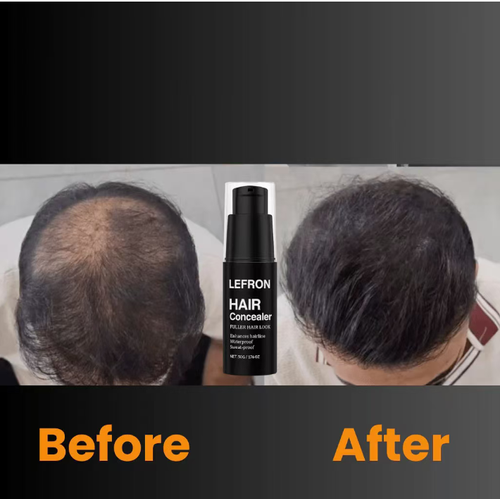 Today, you can get 2 bottles of Magic Hair Concealer! The cream type precisely fills in the hair gaps, with a moisturizing texture that doesn't make the hair look overly white. It lasts for 7 days and is waterproof and sweat-proof, so it won't come off during your commute or workout. It's also made with plant-based ingredients that protect the scalp. It takes just 1 minute to create natural hair volume, and it doubles the effect for a more impressive look!