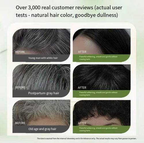 Plant Essential Oil AB Set Salon-Grade Hair Dye, each set includes 2 bottles of AB + 6 accessories. It features 6 layers of plant essence for dyeing and nourishing, with a transparent gel that has no odor. It naturally darkens hair while covering and evening out the color. It takes 30 minutes to achieve salon-like results at home. Order today and get 2 sets for the price of 1. It is gentle on the hair and convenient and cost-effective.