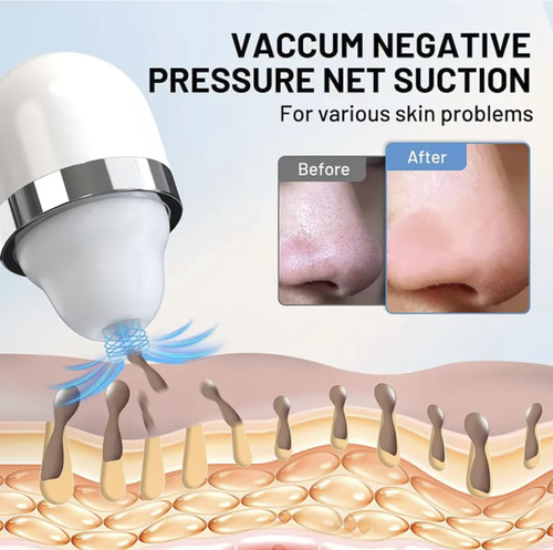 This visualized electric blackhead remover features a high-definition camera for precise and non-blind cleaning. It comes with three types of silicone suction heads, ensuring a thorough clean of the entire face with no blind spots. It gently removes blackheads without damaging the skin barrier, eliminating the need for manual squeezing and skin irritation. It is portable and convenient for home use, making it a professional beauty tool for pore cleansing and blackhead removal.