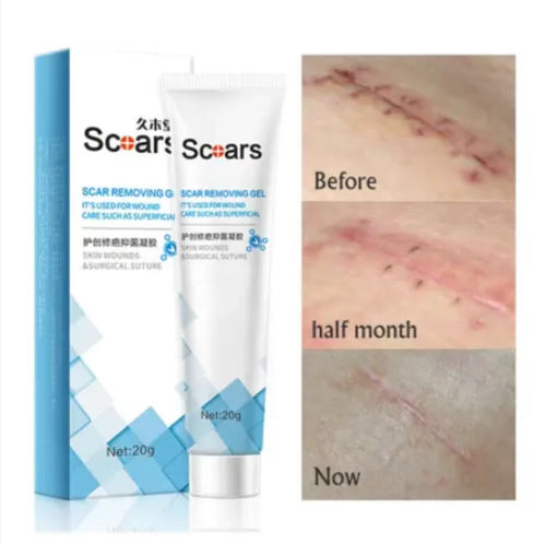If you place an order today, you will receive 5 boxes of Jiugutang Herbal Scar Repair, Anti-Bacterial and Anti-Scarring Gel. This scar repair gel is designed to treat various types of scars. The extracts of licorice root and onion help to inhibit the growth of scars, while small molecule peptides help to promote healing and make the skin softer. It can also reduce pigmentation and restore the smooth texture of the skin!