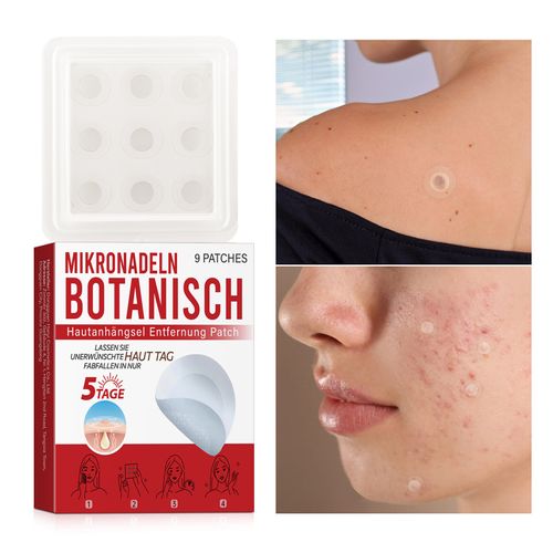 Skin tag removal patch. I placed an order today and received 2 boxes, a total of 162 patches. I have enough to thoroughly remove skin tags on my neck, armpits, and around my eyes. The plant micro-needles gently penetrate, making the skin tags dry and fall off within 5-7 days. The invisible thin patches are not noticeable. Sensitive skin can use it without red marks. You can easily achieve skin purification at home and feel more confident with a bare face!