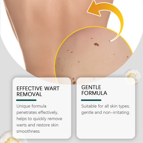 Are you too embarrassed to show your skin because of warts or moles? OLHOE magnesium needle wart removal patch. Magnesium needle + gentle formula, gently adheres to fade blemishes, thin and invisible without embarrassment. Order today and get 3 boxes for the price of 1 box (total 12 patches, 4 patches per box). Even sensitive skin can use it. Easily brighten and smooth the skin, and feel more confident when showing your skin!