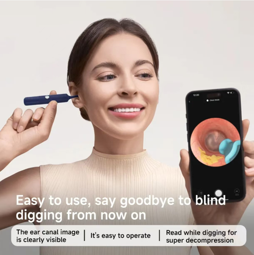 Visualizing Hummingbird Ear Cleaning Device. High-definition camera allows you to clearly see the ear canal in real time. Equipped with a soft ear-digging head and cleaning forceps. Comes with a layered and sealed storage box. The device is divided into sections for adult and child accessories, preventing dust and easy to carry. It can be used directly by connecting to a mobile phone. Safely removes earwax. Suitable for all family members' ear care at home or when going out.