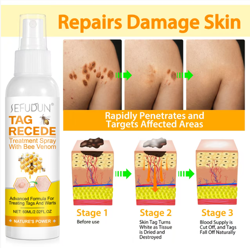 SEFUDUN Bee Venom Anti-Groin Spray, featuring a natural plant extract formula that gently blocks the nutrients of the growths, causing them to fall off painlessly and without leaving any marks. The spray is designed for convenience and precision, effectively repairing skin blemishes. Even sensitive skin can use it with peace of mind.