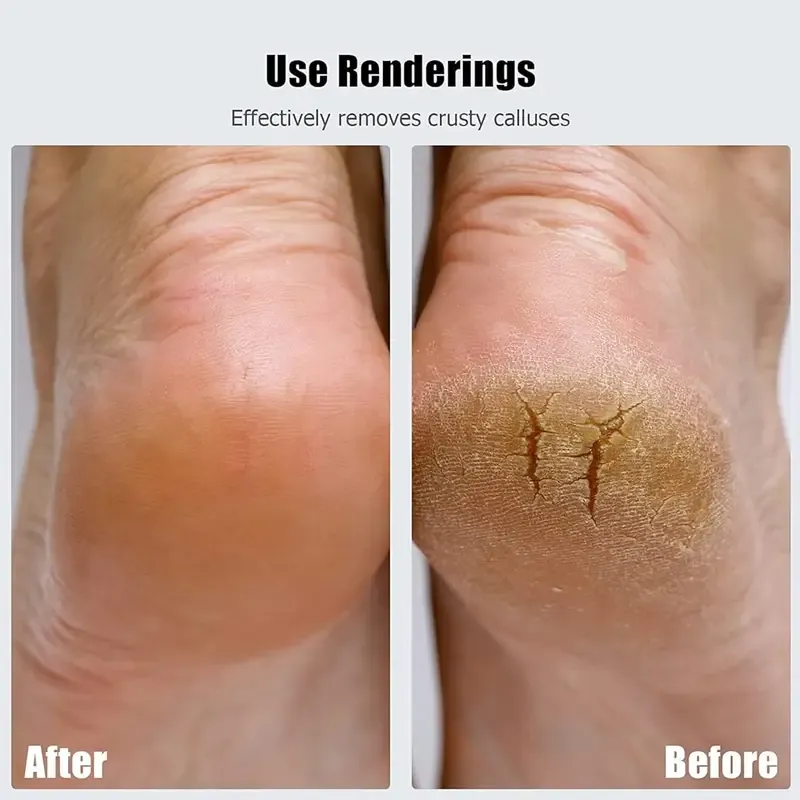 This is not a foot grinding machine, it is clearly a foot polishing machine. When old dead skin and calluses meet it, they are all melted away like snowflakes meeting the sun. After touching my feet, I can't help but sigh, they are so tender!