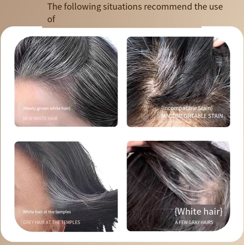 Order today and you will receive 4 small gold-tipped peptide hair styling pens. They have a golden handle with 10 teeth on it. They can fix gray hair and make the hair show its natural color. They have waterproof and sweat-proof functions, making the hair smooth. Just open the package and use it to style your hair. It only takes 2 minutes to cover both sides of your head. Store it in your pocket for emergencies!